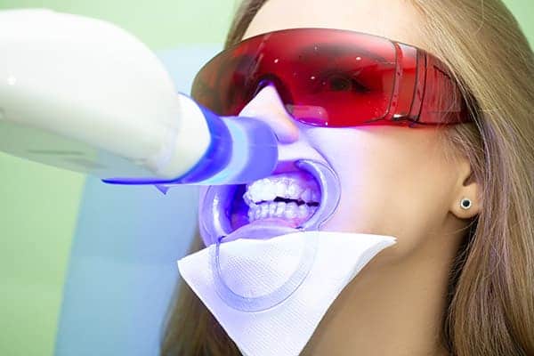 Laser teeth whitening treatments High Wycombe