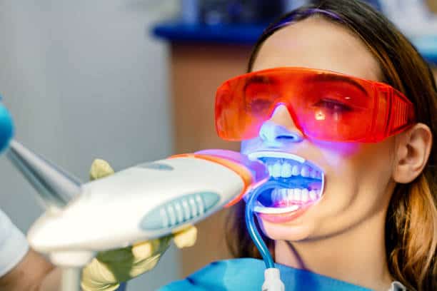 Simplifying Teeth Whitening: A Comprehensive Guide High Wycombe