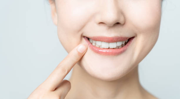 Comparing the Pain Factor: Laser Teeth Whitening vs. Zoom Teeth Whitening High Wycombe