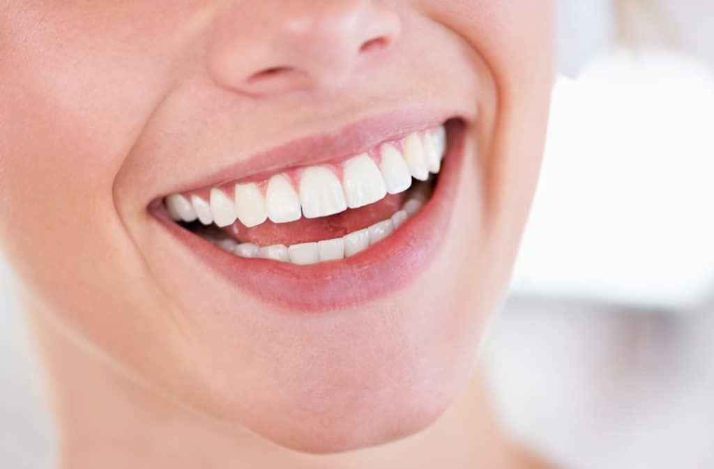 Teeth Whitening West Drayton High Wycombe