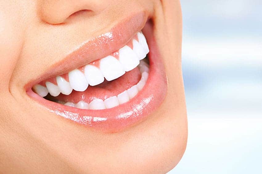 Teeth Whitening Abingdon High Wycombe